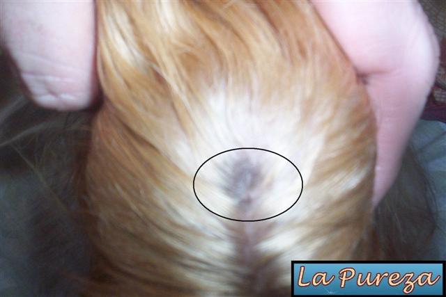 Alopecia