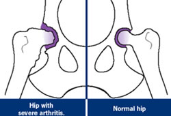 Artritis Canina