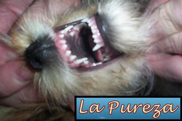 Dientes de Leche Normales